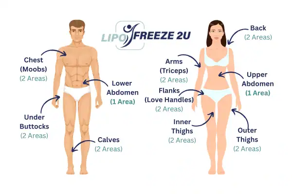 Areas you can have fat freezing treatment Leigh-on-Sea