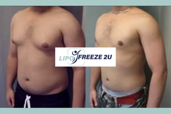 How Long Does It Take to See Results Leigh-on-Sea?