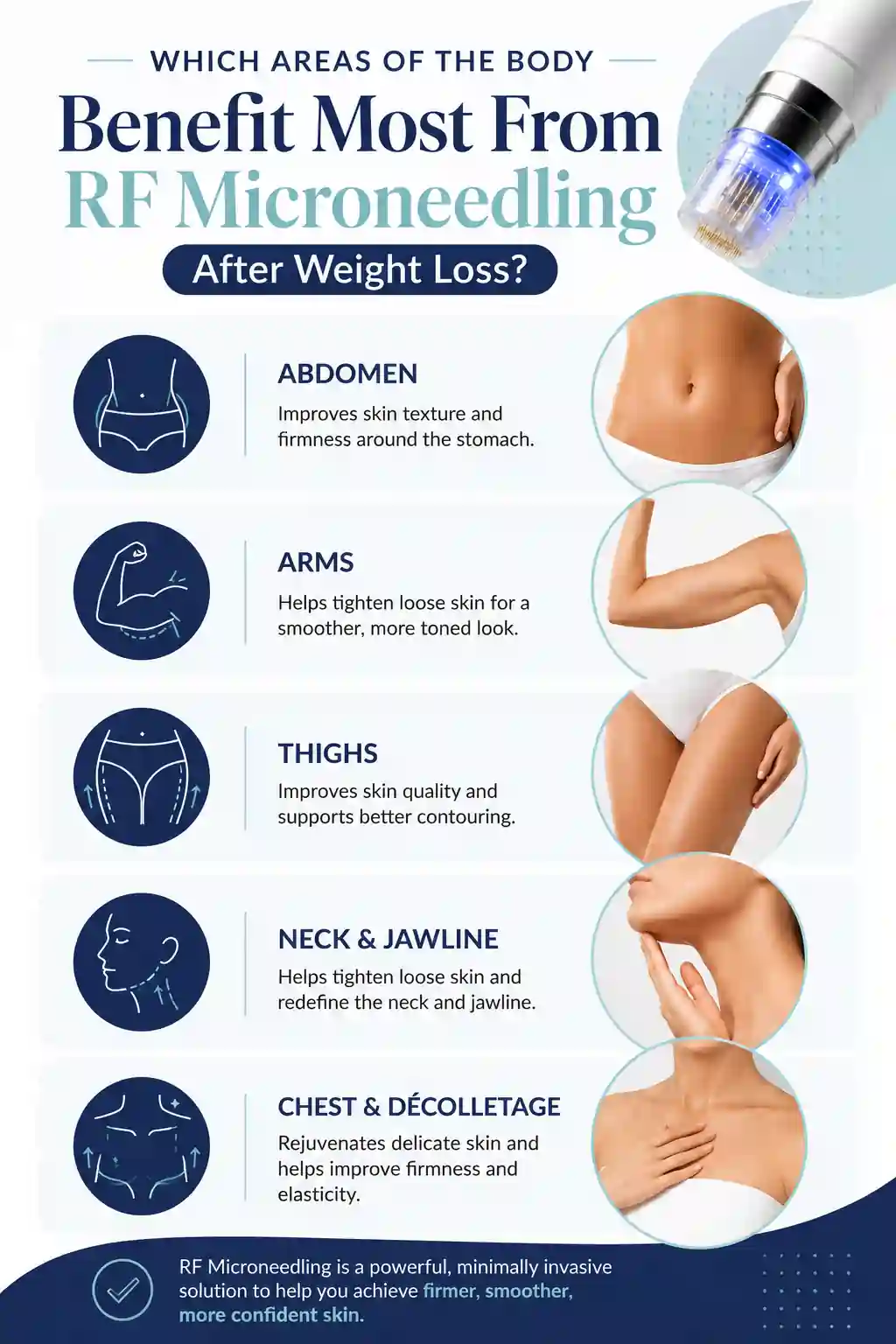 Which Areas of the Body Benefit Most From RF Microneedling After Weight Loss Leigh-on-Sea